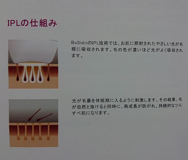 BOSIDINレーザー脱毛器の取扱説明書